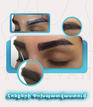 Slider image (3) United Hair Clinic